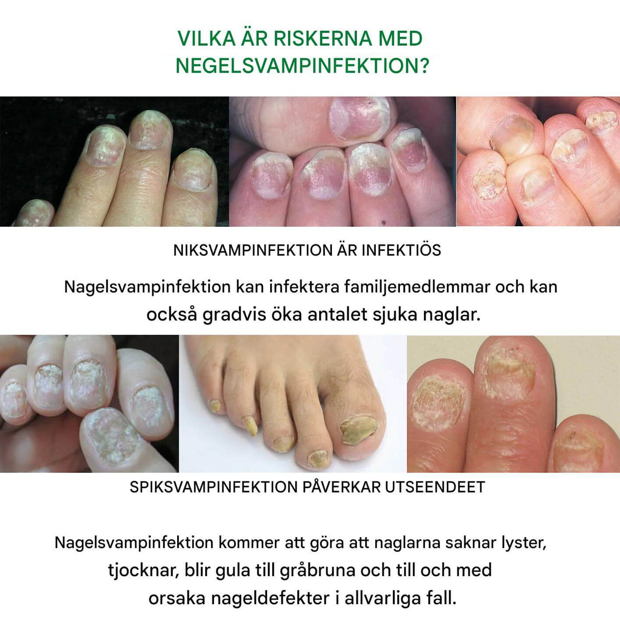 FungiClear – Nagelserum mot Svamp | Effektiv Nagelvård för Starkare Naglar