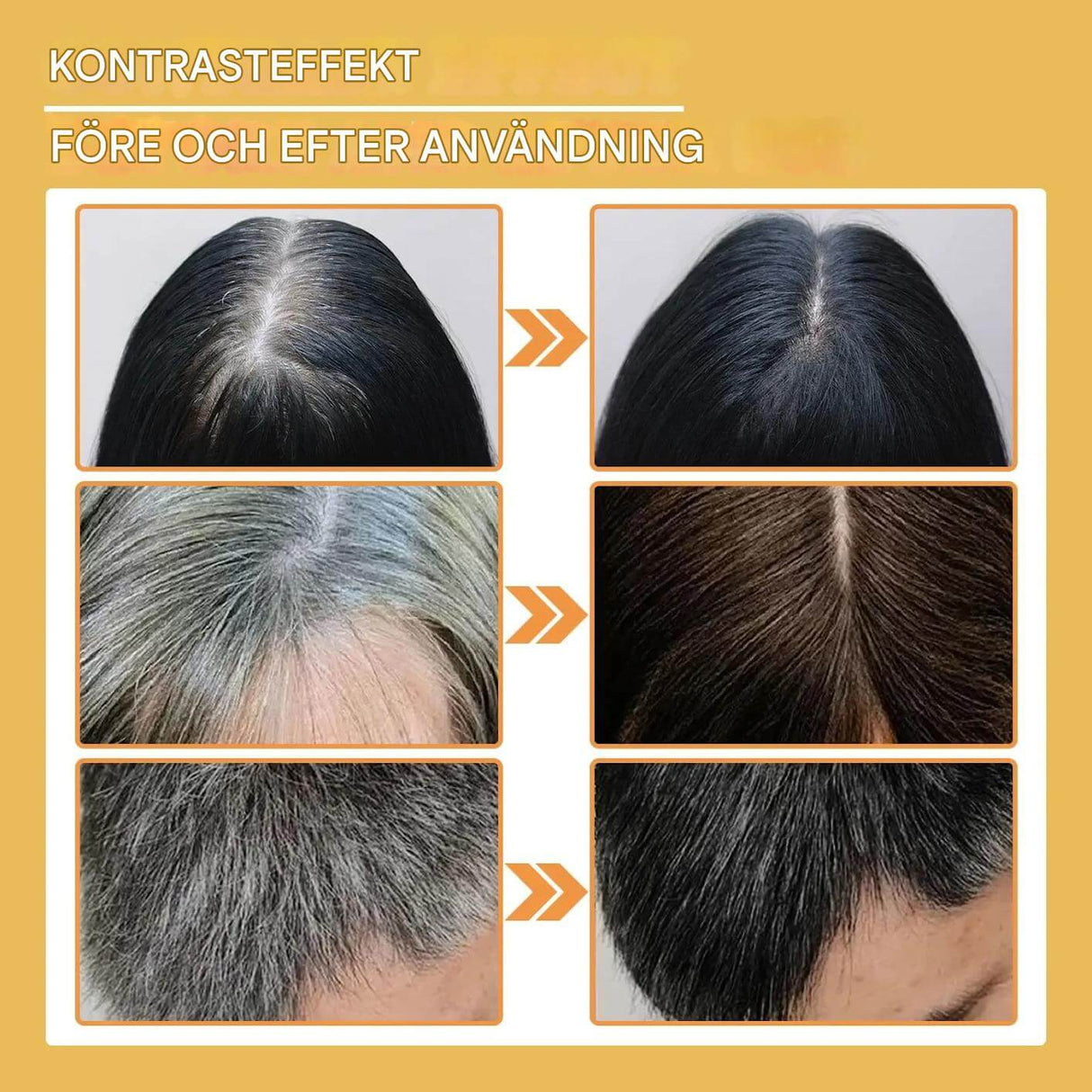 ToneRoot Serum – Hårserum för Grått och Vitt Hår | Naturlig Färgförbättring och Näring för Hårbotten