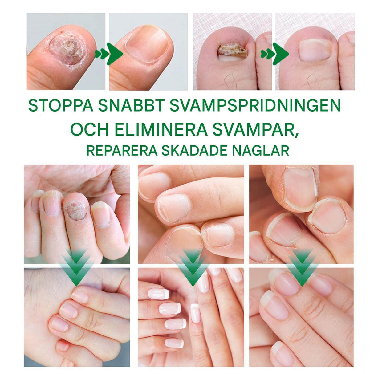 FungiClear – Nagelserum mot Svamp | Effektiv Nagelvård för Starkare Naglar