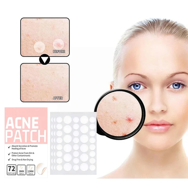 PoreClean - Patchs anti-acné à l'hydrocolloïde pour une peau nette en une nuit