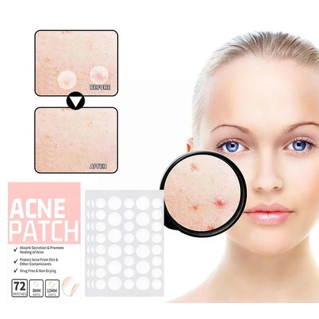 PoreClean - Patchs anti-acné à l'hydrocolloïde pour une peau nette en une nuit